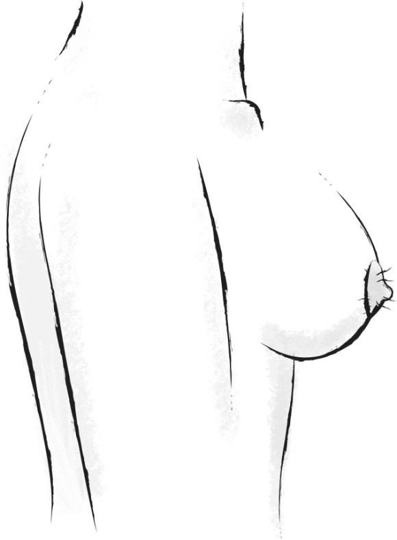 Types of Nipples | True&Co.